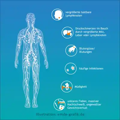 Chronic lymphocytic Leukemia