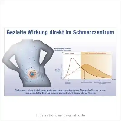 Liniendiagramm + Aufmachergrafik Gezielte Wirkung von Schmerzmittel (in Zusammenarbeit mit Annette Gack)