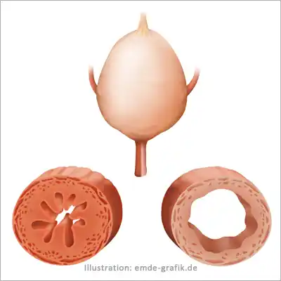 Urological illustration of the ureter and bladder