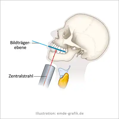 Illustration für zahnmedizinische Schulung: korrekte Anwendung des Röntgengerätes