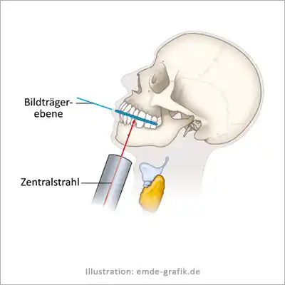 Illustrations for dental training: Correct use of the X-ray machine