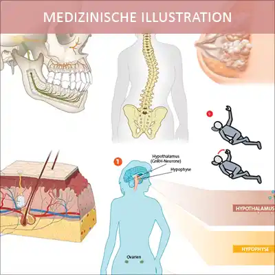 Medizinische Illustrationen