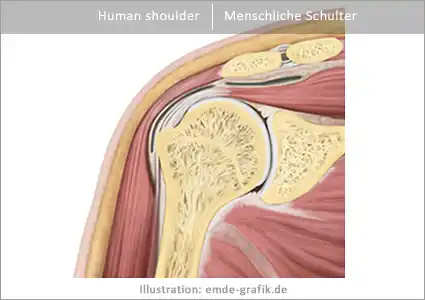 Schnitt durch menschliche Schulter, Supraspinatus-Sehne